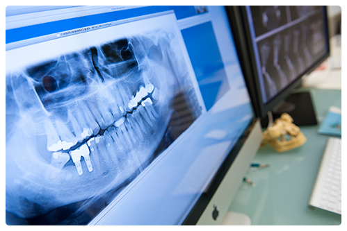 Tecnologia Clinica Dental Pamplona